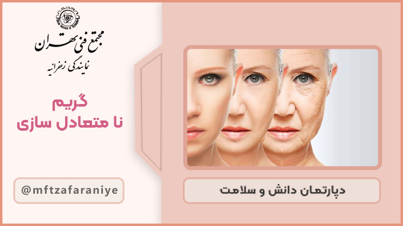 گریم نامتعادل سازی